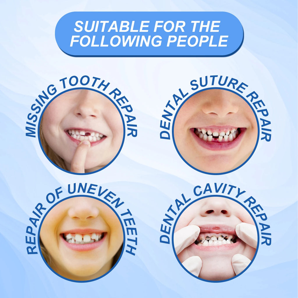 Resin Temporary Tooth Repair Granules Teeth Gaps Missing Broken Tooth Filling Moldable Adhesive Dentures False Teeth Tools