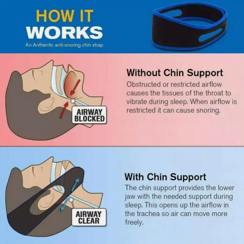 High Quality 2 PCS New Anti-Snoring Chin Strap Relieve Snoring Breathe Through The Nose Improve Sleep