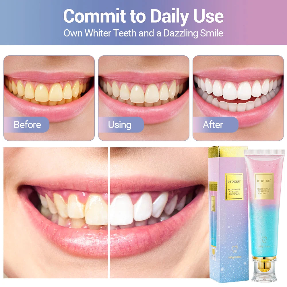 Niacinamide Whitening Toothpaste Refreshing Clean Teeth For Men And Women Fresh Breath Toothpaste To Remove Surface Stains