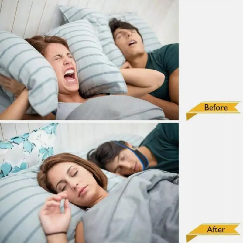 High Quality 2 PCS New Anti-Snoring Chin Strap Relieve Snoring Breathe Through The Nose Improve Sleep