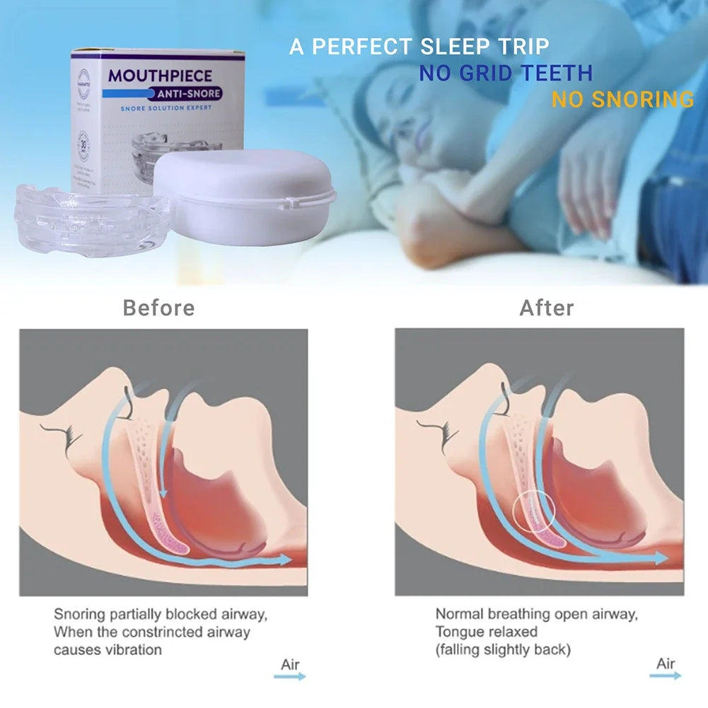 Reusable Anti Snore Mouth Guard with Storage Box Anti Snoring Teeth Bruxism Mouthguard Improve Sleeping Reduction Snoring Device