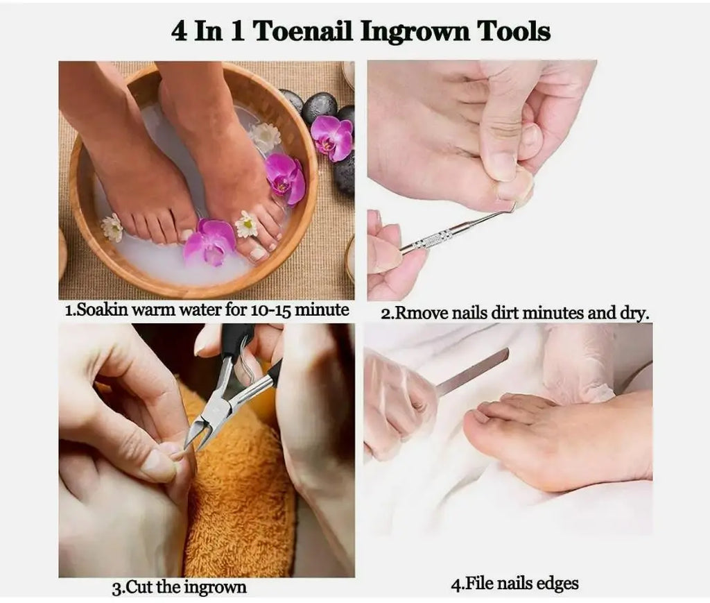 Professional Thick Nail Dead Skin Dirt Remover Super Sharp Curved Blade Nail Tools Toe Nail Clippers Cutter Ingrown Toenail Tool